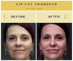 Gregory Lakin, MD...