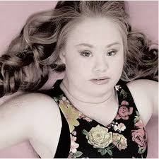 Model mit Downsyndrom sorgt für Begeisterung