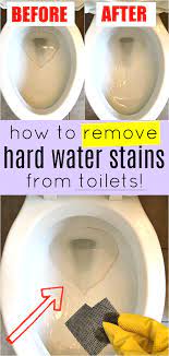 How To Remove Hard Water Stains From Toilets Hard Water Stain Remover Cleaning Toilet Stains Hard Water Stains