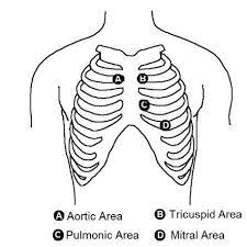 2017 esc guidelines on the diagnosis and treatment of peripheral arterial diseases, in collaboration with the european society for vascular surgery (esvs): Cardiac Auscultation Areas Download Scientific Diagram