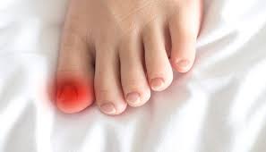 Du lundi au vendredi de 9h à 13h et de 14h à 18h Ongles Incarnes Quelles Sont Les Causes La Vie Naturelle
