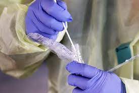 Время работы в cубботу с 8:00 до 14:00 Gde I Po Kakoj Cene Mozhno Sdat Pcr Test V Stolice