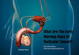 The longer treatment is delayed, the here are some of the symptoms of testicular cancer, which you could have noticed before you went to the doctor. What Are The Early Warning Signs Of Testicular Cancer
