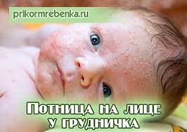 что можно есть при грудном вскармливании в первый месяц список Kak Izbavitsya Ot Potnichki U Rebenka Lechenie Potnicy Na Lice Grudnichka Detskie Sovety Planirovshik Dlya Mam Novorozhdennyj Malchik