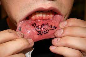 Tattoos are common place nowadays, but have you ever thought about what tattoo ink may be doing to your body? Lip Tattoos Help Dental Patients Think Before They Ink Today S Rdh