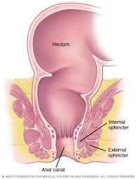 For some tumors, chemotherapy or — for rectal cancers. Anal Cancer Symptoms And Causes Mayo Clinic