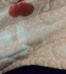 Kami memiliki database lebih dari 122 ribu. Berdarah Darah Tangan Di Gigit Abs Pest Mobil Alor Setar Facebook