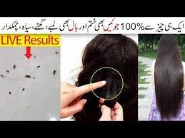 Lice In Hair 100 Removal Remedies Also Useful For Long Shiny Hair Urdu Hindi Youtube Long Shiny Hair Beauty Tips For Skin Beauty Hacks
