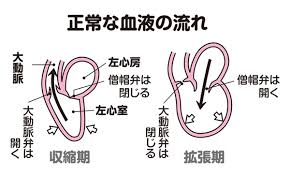 Manage your video collection and share your thoughts. å¤§å‹•è„ˆå¼ç‹­çª„ç—‡ã¨ã¯ æ¸¡é‚Šå‰› å…¬å¼ã‚µã‚¤ãƒˆ