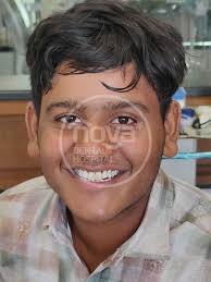 Dentist in Gandhinagar, Dental Treatments