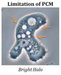 Disadvantages Of Phase Contrast Microscopy Microscopy Biology Class Contrast