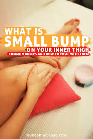 What Causes Bumps On The Inner Thighs In 2020 Inner Thigh Boils Inner Thigh Bumps Inner Thigh