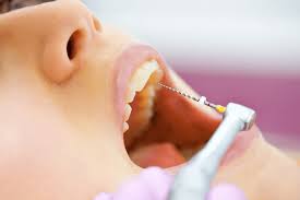 Symptoms you need a root canal. How To Know If Your Tooth Needs Root Canal Symptoms And Treatment Rozenberg Dental Nyc General Dentists
