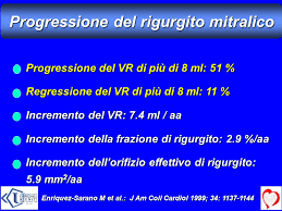 Il bello è che a volte mi succede anche. Insufficienza Mitralica Storia Naturale E Diagnostica Strumentale Ppt Scaricare