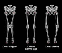 Vous êtes en bonne santé, mais vous avez un métier qui exige de rester debout très longtemps ? Soins De Podologie Semelles Orthopediques A Geneve I Jd Podologie