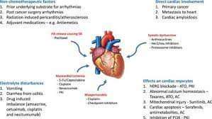 Cancer Treatment Induced Arrhythmias Circulation Arrhythmia And Electrophysiology