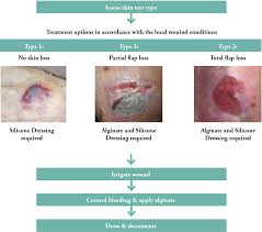 Image result for Skin Tear