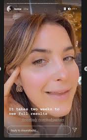 The Secret World of Free Botox for Influencers and Editors