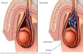 Testicular cancer is one of the less common cancers, and while it's one of the most treatable types, it's important to know the early signs. Scrotal Masses Symptoms And Causes Mayo Clinic