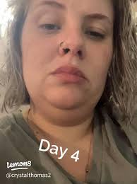 What Are the Risks of DNC Surgery and How to Manage Recovery Safely?