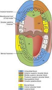 Pin On Lets Study Dental
