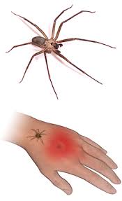 Image result for Tarantula Bite