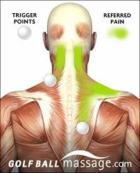 Pin On Myofascial Pain Trigger Points
