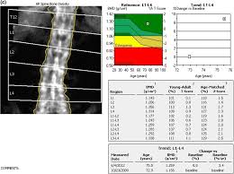 A Practical Approach To Interpretation Of Dual Energy X Ray