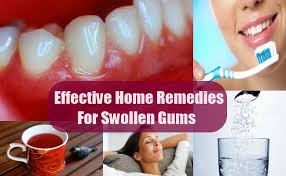 sore inflamed gums pain relief home