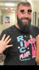 Hey, Mattman, how long til them eyebrows grow back?! 😂