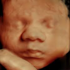 5D HD Ultrasound at 37 Weeks + 3 Days ❤️ ❤ It's not too late for a 5D  ultrasound at 37 weeks, as long as you're well hydrated! 3dbabyboutique.com