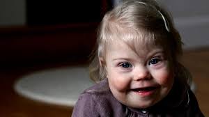 The risk of having a child with. Down Syndrom Funf Fragen