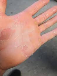 Weiss Jemand Ob Das Ein Pilz Ist Hand Pilze