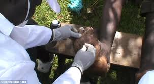 The removal of jiggers parasitic foot feet in terrible condition v3people helped to remove jiggers from rhodah`s feet.thanks for watching! Jigger Fleas Burrow So Deep That Victims Must Have Them Cut Out Of Their Skin Daily Mail Online