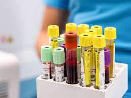 But just wondered how long other peoples have taken ? 10 Important Blood Tests What They Show Why They Re Done More