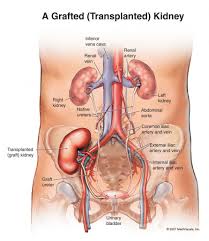Due to the location of the organ, which is in the upper abdominal area, adjacent to back muscles, pain from kidney stones may be felt in the left or right side of your back. Lower Back Anatomy Organs
