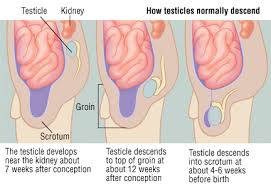 Undescended Testicle Cryptorchidism Harvard Health