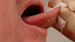 Ca sa faci cancer la limba trebuie sa pacatuiesti destul de mult cu limba in sensul vorbelor care nu se cuvin sau care nu fac bine la altii. Atentie Fumatori Primele Simptome Ale Cancerului Oral Se Vad Nu Se Simt Mobile
