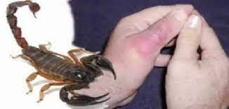 Check spelling or type a new query. Ù„Ø¯ØºØ© Ø§Ù„Ø¹Ù‚Ø±Ø¨ Scorpion Sting Ø§Ù„Ø¯ÙƒØªÙˆØ± Ù…Ø§Ø²Ù† ÙƒØ±Ø¯ÙŠØ©