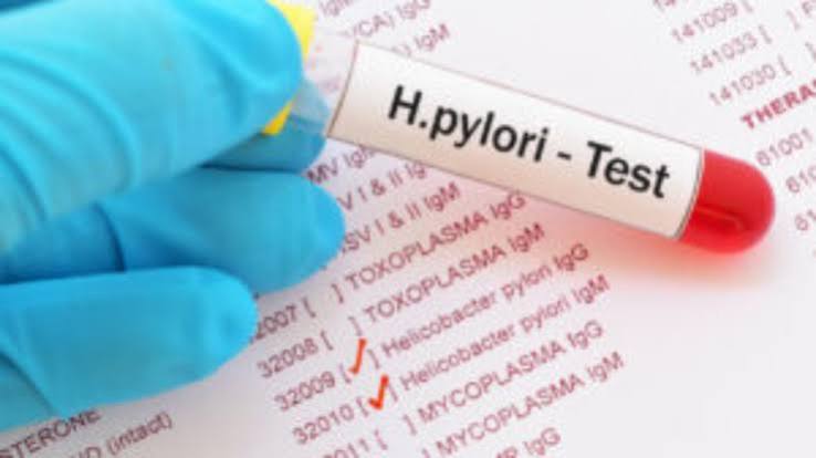 helicobacter pylori infection