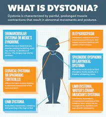 Dystonia Parkinson S Disease