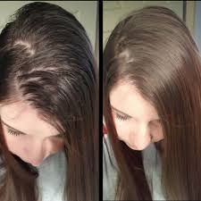 Do you have frizzy hair, dry hair or staticky hair? 15 Things That Ll Help Refresh Your Hair Between Washes