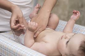 La Hernia Inguinal Por Que Mi Bebe Tiene Un Bulto En La Ingle Y Como Se Soluciona Este Problema Congenito