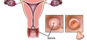 We did not find results for: 10 Gejala Kanker Serviks Dan Cara Mencegahnya Hot Liputan6 Com