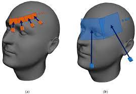 Tissue necrosis (death of cells) and secondary infection of previously irradiated tissue is a serious complication for patients who have undergone rt for head and neck cancer. Sensors Free Full Text The Roscan Thermal 3d Body Scanning System Medical Applicability And Benefits For Unobtrusive Sensing And Objective Diagnosis Html