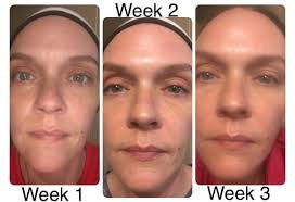 marykay.com/lbrush Try the Clinical Solutions 😍!!! Retinol 0.5 PLUS we  have a Facial Milk that calms skin. 😁