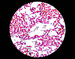 Image result for Clostridium