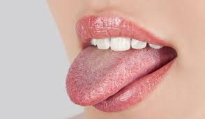 Ce provoaca umflaturi pe buze? Limba VorbeÈte Despre SÄnÄtatea Ta Cum Identifici O EventualÄ AfecÈiune Dr Leahu Dental Clinics
