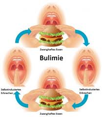 Manche sterben an der sucht. Bulimie Ursachen Beschwerden Therapie Gesundpedia De