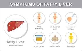 Fatty Liver Diet Guide